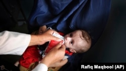 آرشیف - یک کودک مصاب به سوء تغذیه در یکی از کلینک های صحی یونیسف در جبرالسراج.