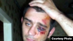 Избитый украинский журналист Артем Фурманюк. Донецк, 20 сентября 2010 года.