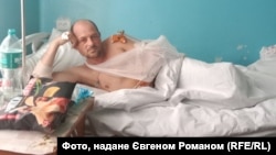 Лікування було довгим