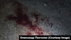 Багато поранених мали великі крововтрати