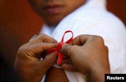 Ушбу кўринишдаги қизил тасма ОИВ/ОИТСга қарши кураш рамзи ҳисобланади.