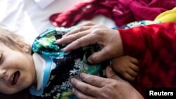 یک کودک مبتلا به سوء تغذیه در یکی از شفاخانه های کابل - عکس از آرشیف