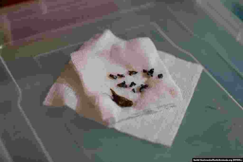 Авдеевканын алдындагы медициналык жайдын дарыгерлери жарадар болгон бейтаптардын денесинен алып чыккан ок-дарынын сыныктары. 2024-жылдын март айы.&nbsp;