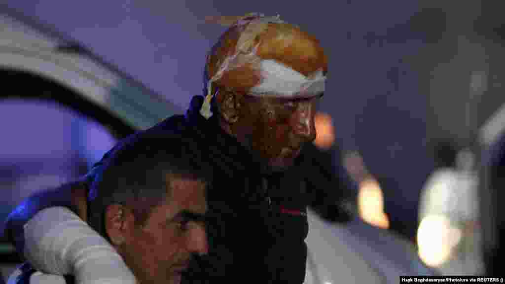 Тоолуу Карабактагы&nbsp;Степанакерттеги күйүүчү май сактаган кампада болгон жарылууда жабыркаган адам. Ал Еревандагы күйүк борборуна жаткырылды.&nbsp; Жикчил аймактын акыйкатчысы&nbsp;Гегам Степанян &quot;Азаттыктын&quot; армян кызматына жарылууда 68 адам каза тапканын билдирди. Жарылуу адамдар түшкөн машине Арменияга бараткан жолдо бензин куюу үчүн кезекте турганда болгон.&nbsp; &nbsp;