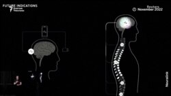 Маск кишинин мээсине Neuralink орнотот