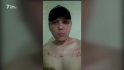 «Сыпали на рану соль, наливали хлор». Заключённый сообщил о пытках в карагандинской тюрьме   