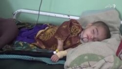 افزایش میزان سوء تغذی در میان اطفال؛ راه حل چیست؟