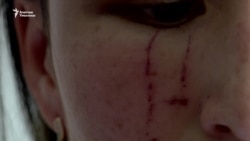 “Көзүмдү чукуду”. Бишкекте "Тез жардамдын" дарыгери сабалды