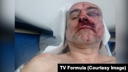 Давид Кацарава в больнице