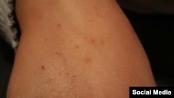 Ийне сайылды делген окуучунун колу. Социалдык тармактардан алынган сүрөт