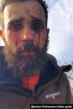 Фермер з Миколаївщини Дмитро Єлісеєнко. Його трактор підірвався на міні