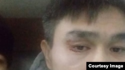 Айдар Сызыков полиция кармагандан кийин тарткан сүрөтү.