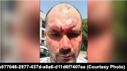 Атамурад Сапаров