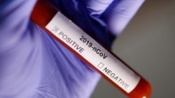 Հայաստանում կորոնավիրուսի հաստատված արդեն 18 դեպք կա