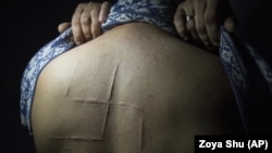 Більшість цивільних, яких Росія тримає у в'язницях на окупованих територіях, піддавалися тортурам