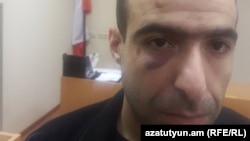 Ազատ Հակոբյան, արխիվ