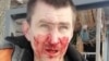 Sergei Sherementyev said he was assaulted by three individuals who were transported to the site by ex-lawmaker Pyotr Fink.