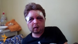 Палітоляг руху Femen кажа, што яго зьбілі спэцслужбы