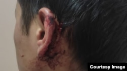 Ҳизбулло Тоҷиев аз гӯш ва дасташ ҷароҳат бардоштааст.