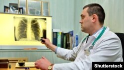 Дүйнө жүзүндө бул дарттын оор формасына чалдыккандардын 20 проценти чылым тартуудан улам экени аныкталган. 