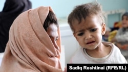 یکی از افراد مبتلا به سوء تغذیه که در شفاخانه میرویس ولایت کندهار تحت تداوی قرار گرفته است
