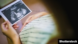 Иллюстрация.