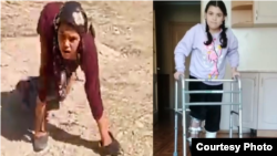 Мавлуда Латипова до и после операции