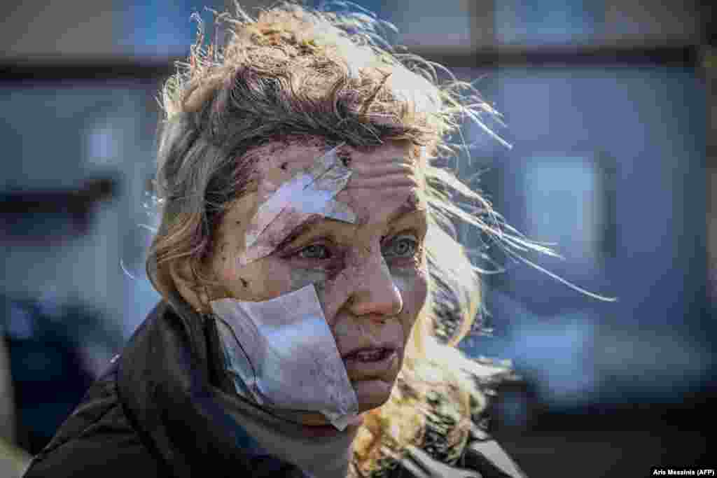 As Russian troops began their invasion of Ukraine on February 24, 2022, 53-year-old teacher Olena Kurylo was injured in a strike on the city of Chuhuyiv. &quot;I never thought that such a thing could happen. I never thought that this would truly happen in this lifetime,&quot; she said.
