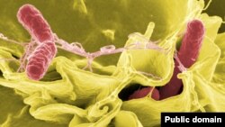 Сальмонелла (выделена красным) атакует культуру клеток человека. Съемка электронным микроскопом