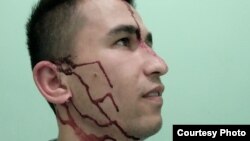 Абдулло Гурбати после нападения разместил свое фото со следами избиения в Фейсбуке