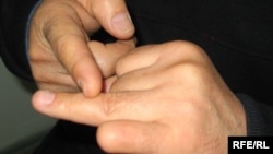 Руки Тахиржана Ахметова с отрезанным в знак протеста мизинцем. Алматы, 9 февраля 2009 года.