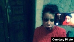 Тетяна Чорновол через кілька годин після побиття, 25 грудня 2013 року