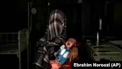 کودک مبتلا به سو تغذیه