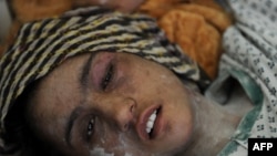 Як зани афғон баъд аз лату кӯби пайвандони шавҳараш