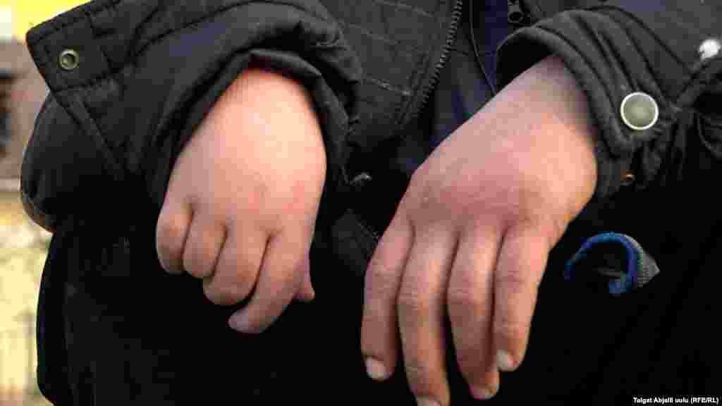 Ильяздын айтымында, ымыркайында менингит&nbsp;оорусуна чалдыгып, бир кол, бир буту жакшы иштебей калган.