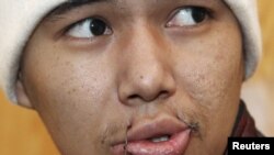 Оозун төөнөп алгандардын бири, 24-январь, 2012-жыл