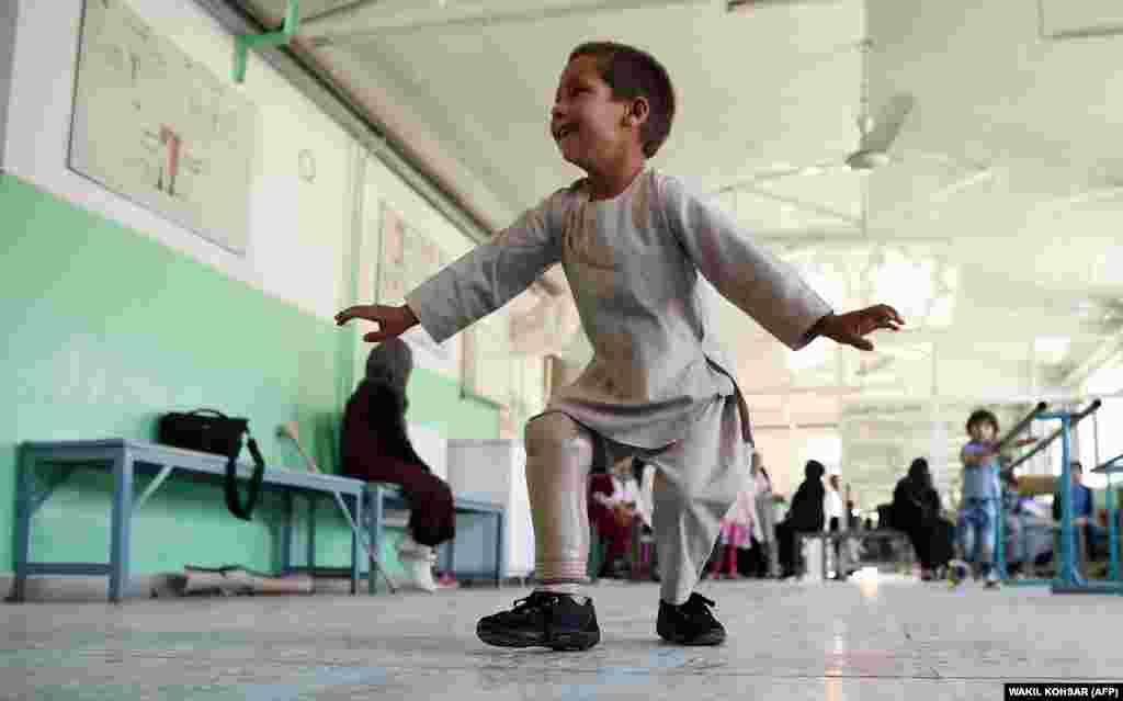 Ахмад Саид Рахман, пятилетний афганский мальчик, потерявший правую ногу во время перестрелки, танцует с протезом на мероприятии, организованном Красным Крестом в больнице для пострадавших в войне. Кабул, 7 мая.&nbsp;