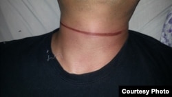 Доведенный до самоубийства Мирбек Тешебаев