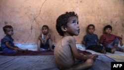 Ушул аптада жүздөн ашык уюм Газада ачкарчылык башталганын билдирген. 