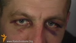 «Беркутівці» скакали по моїй голові і фотографувалися – активіст, якого роздягнув «Беркут»