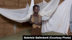 Малавинин кичинекей тургуну. 