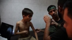 Сирия: раненые в городе Алеппо