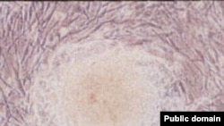 Эмбриональная стволовая клетка человека.