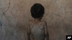 Ілюстраційне фото. Дворічний хлопчик у місті Газа, липень 2025 року