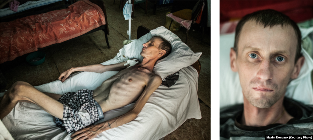 Віктор, 36 років. Діагноз: мультирезистентний туберкульоз і СНІД. Херсонський протитуберкульозний диспансер, липень 2011 року. Працював на фабриці пластикових виробів. Захворів на пневмонію. Про те, що хворий на туберкульоз, дізнався рік тому. За цей час схуднув на 15 кілограмів. Після семи місяців лікування був виписаний, але повторно потрапив на лікування. Помер 7 вересня 2011 року. Залишилися дружина і 14-річний син.