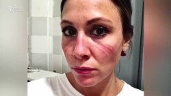 Италияда 10 миң дарыгерге вирус жукту