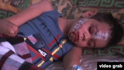 Хлопчик Миколка, який втратив дві ноги і одну з рук унаслідок вибуху міни, фото ілюстративне