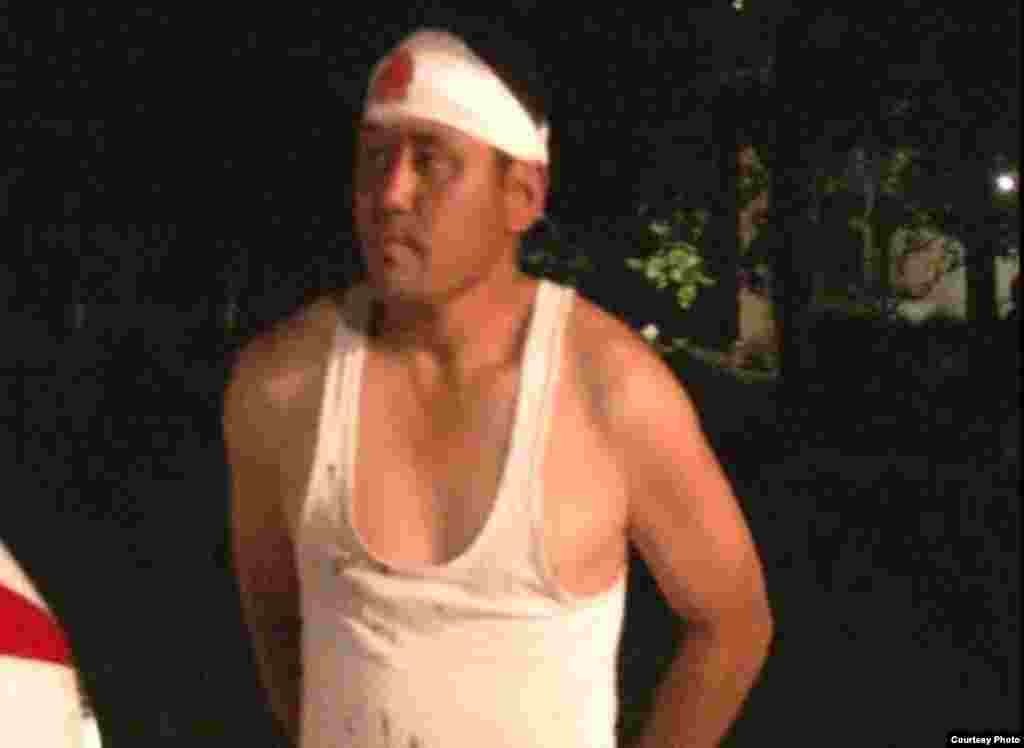 Түнкү жаңжалдан жабыркаган кыргыз жараны, Жака-Өрүк, 8-май.