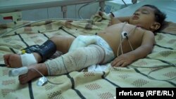 Кабулдагы бомба чабуулунда жараат алган 240 адамдын арасында мына бул наристе да бар. 7-август 2015