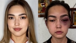 Узбекистанка с ребенком сбежала от мужа после побоев